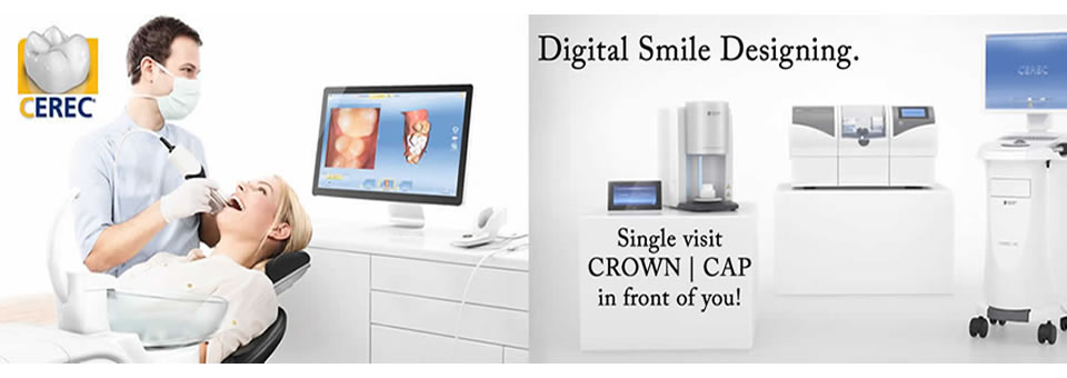 CEREC Support, CEREC Club